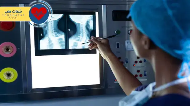 كم أسعار الأشعة المقطعية في السعودية؟ 4 أسعار الأشعة المقطعية في السعودية