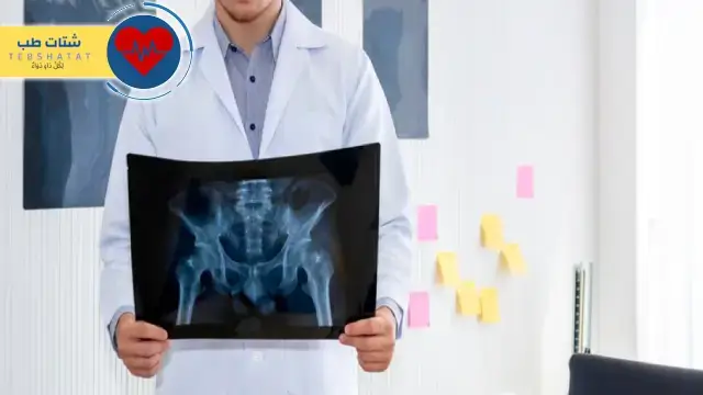 أفضل دكتور عظام في سليمان فقيه