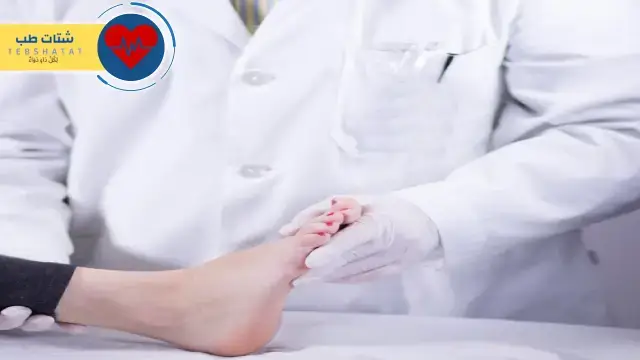 أفضل دكتور لعلاج التهاب اللفافة الأخمصية