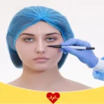 أسعار عمليات تجميل الأنف في مستشفى دلة