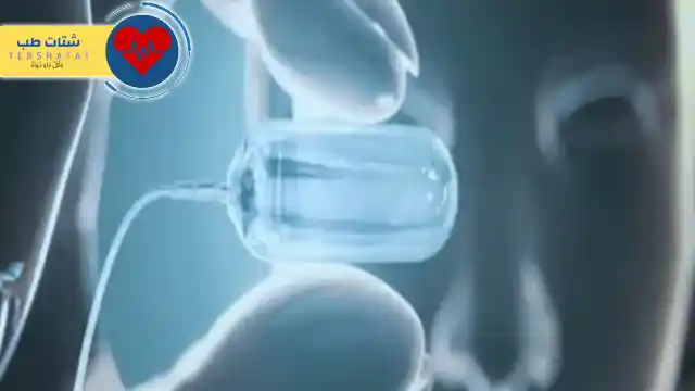 سعر الكبسولة الذكية في السعودي الألماني