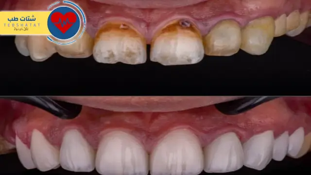 مجمع الزقزوق لطب الاسنان