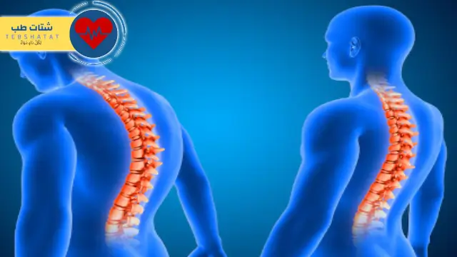 تكلفة عملية الانزلاق الغضروفي في مستشفى الحبيب