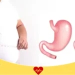 تكلفة عملية التكميم الدكتور عائض القحطاني