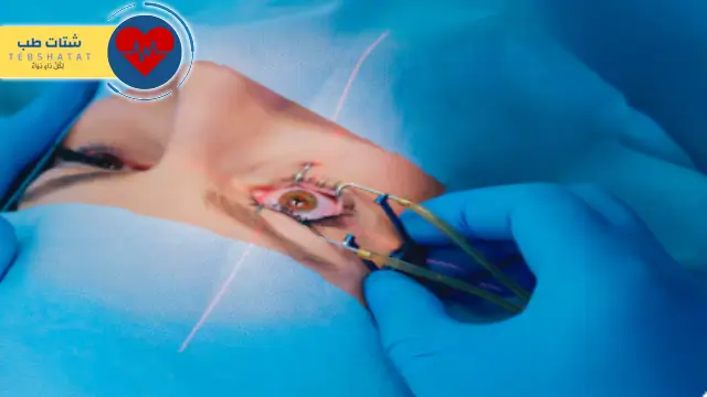 أسعار حقن شبكية العين في السعودية أسعار حقن شبكية العين في السعودية