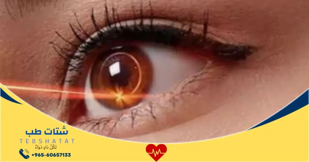 سعر عملية تصحيح النظر في الحبيب 2 سعر عملية تصحيح النظر في الحبيب