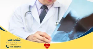 كم تكلفة عملية منظار الكتف في السعودية؟ التفاصيل كاملة