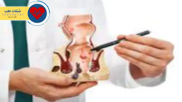 تجربتي مع عملية الشرخ بالليزر