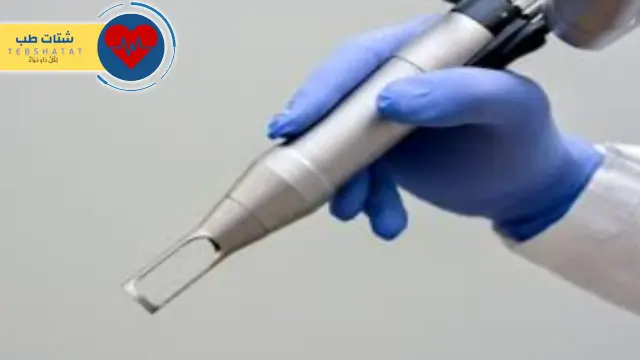 تجربتي مع عملية الشرخ بالليزر