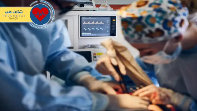 تكلفة عملية قسطرة القلب