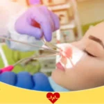 تكلفة عملية الجيوب الأنفية