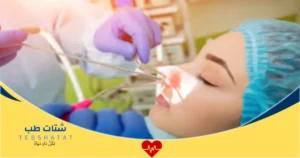 تكلفة عملية الجيوب الأنفية في الرياض والسعودية الأسعار والأنواع