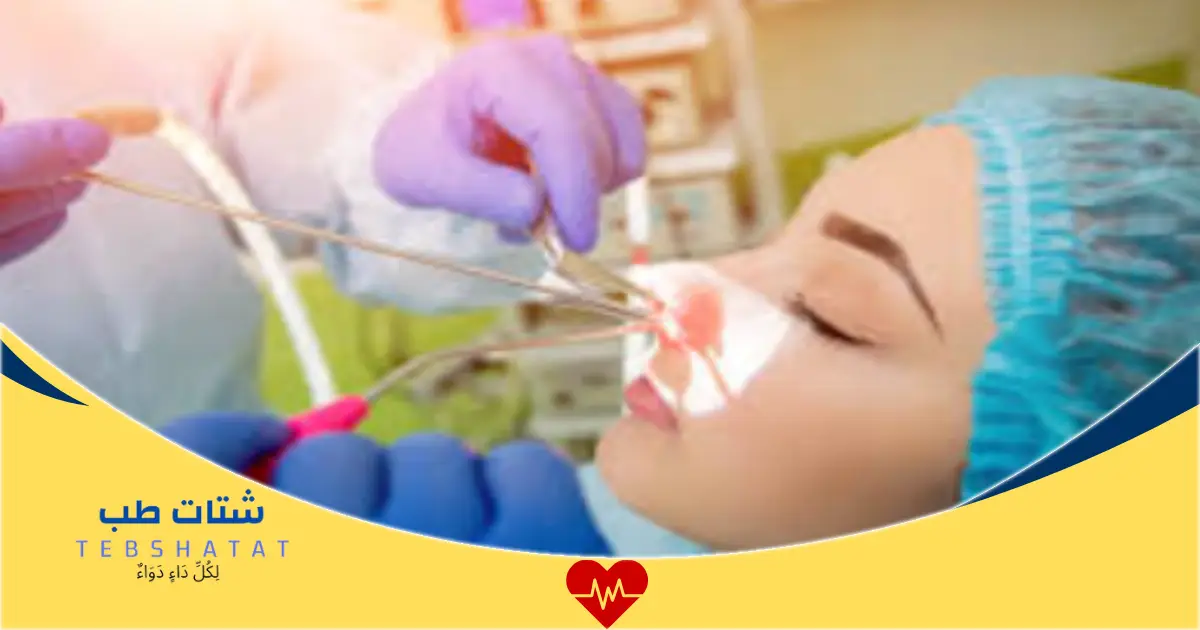 تكلفة عملية الجيوب الأنفية