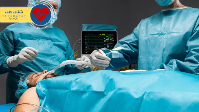 تكلفة عملية قسطرة القلب