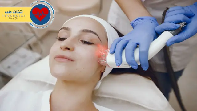 أفضل عيادة فراكشنال ليزر