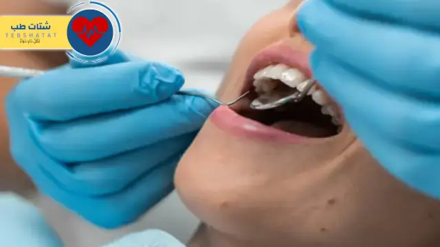 عيادات أسنان تبوك